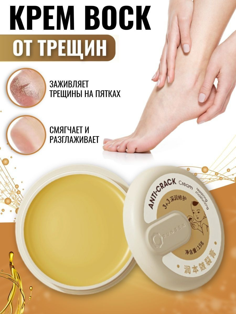 Vinnitsadagi transseksuallar Uchlik haqida maqolalar