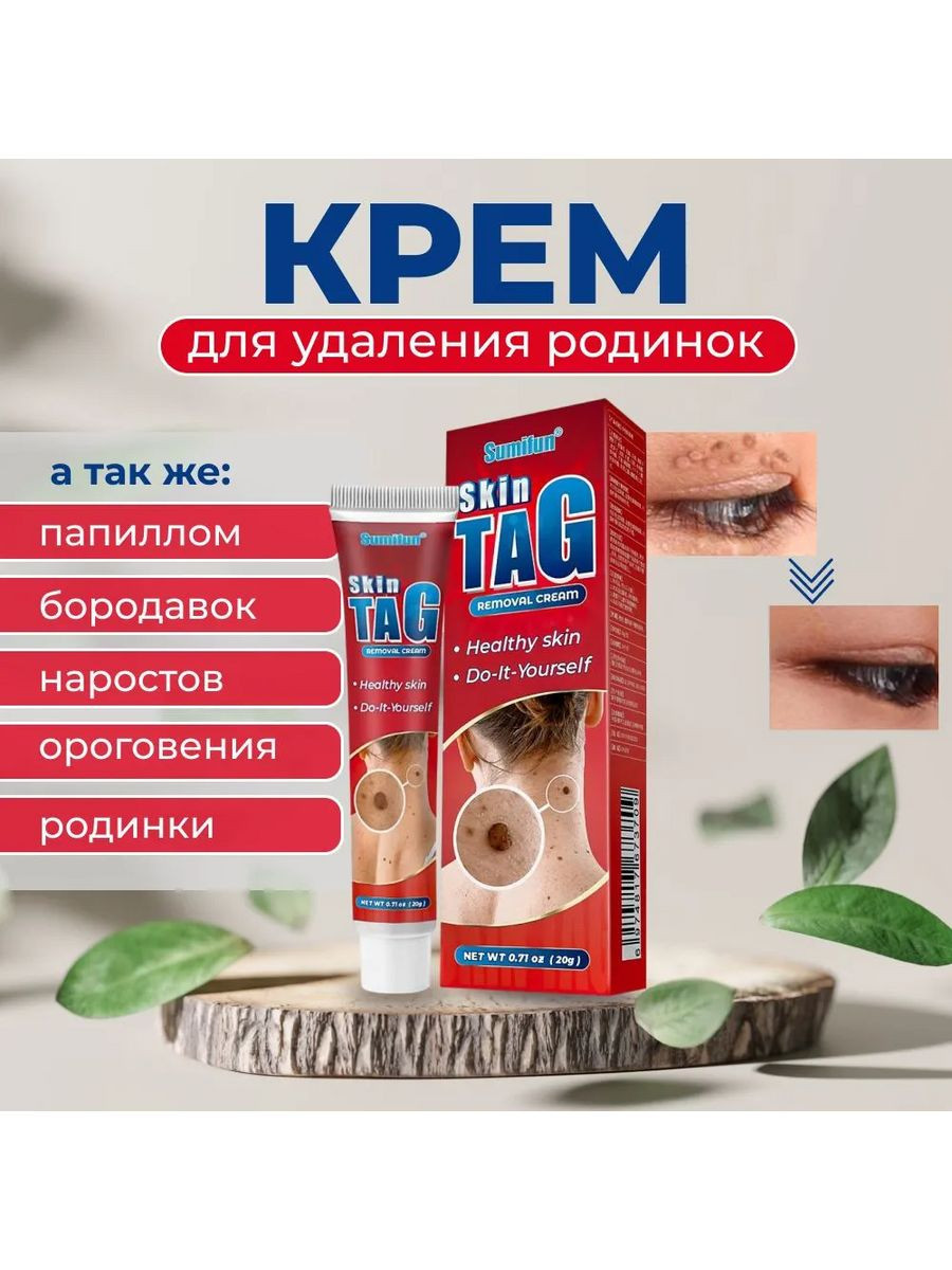 Siğil va papillomalarni olib tashlash uchun krem - 20 g teri yorlig'i Toshkentda hududida, narxi 140000 so'm Allshop.uz korxonasidan - Prom.uz (ID#1223805)